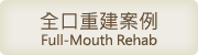全口重建